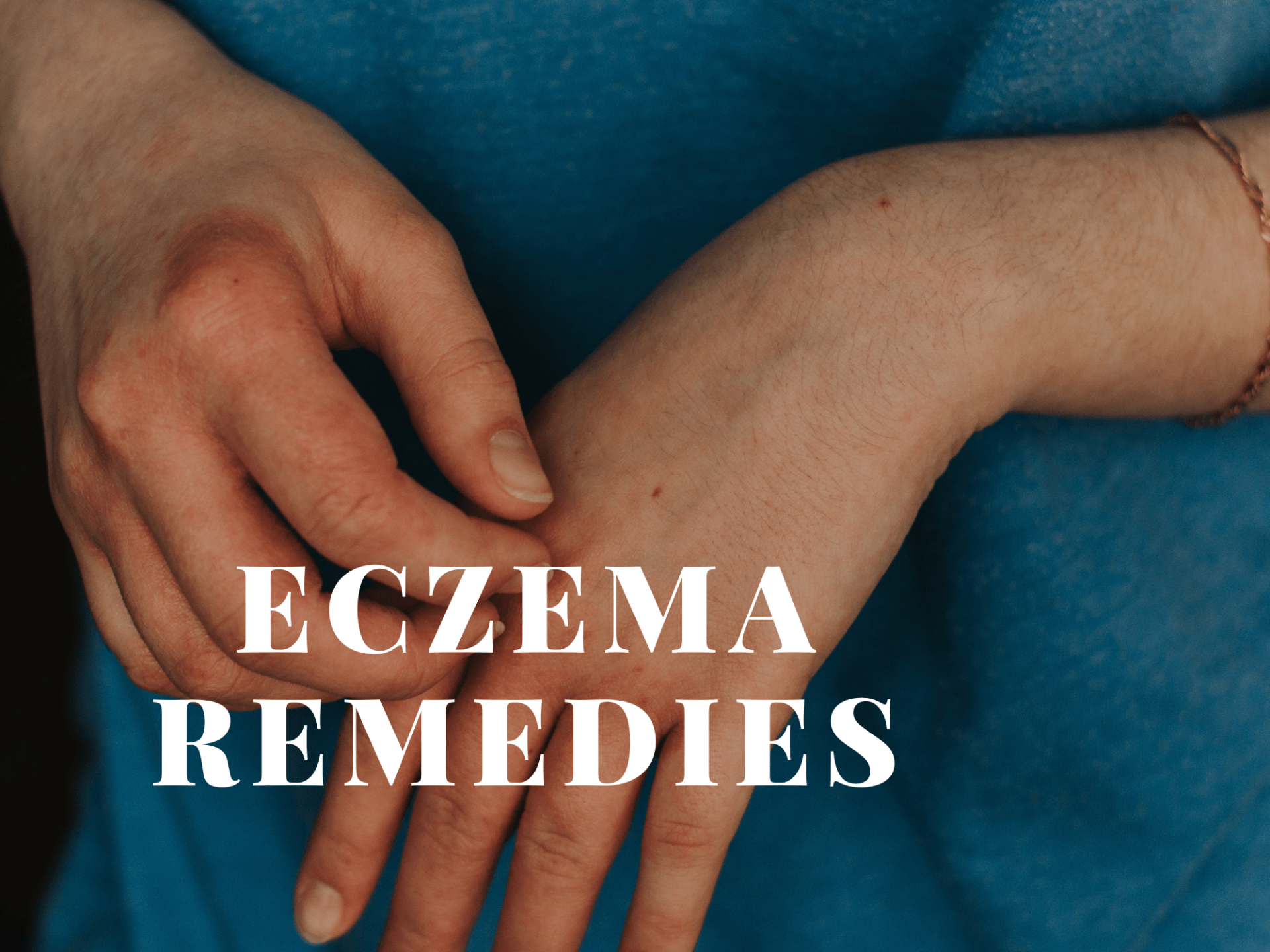 How To Prevent An Eczema Flare Up